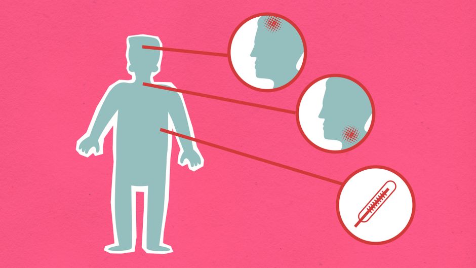 Ilustração explicativa sobre os sintomas e a transmissão da febre amarela, com foco na identificação de sinais epidemiológicos.