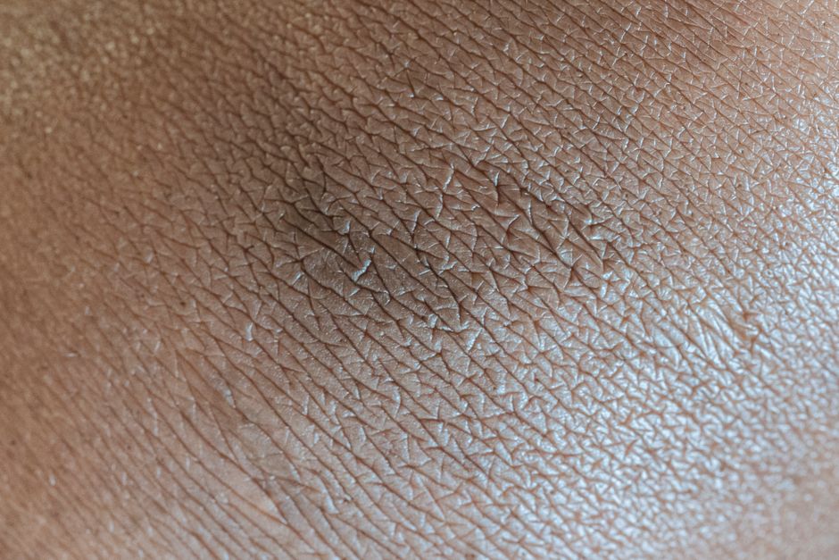 Primeira etapa do processo de terapia de tatuagem, mostrando a pele sendo preparada para a aplicação da tinta.